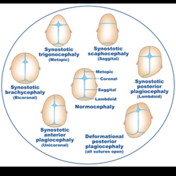 Awareness 💜 - Picture 2 of 3